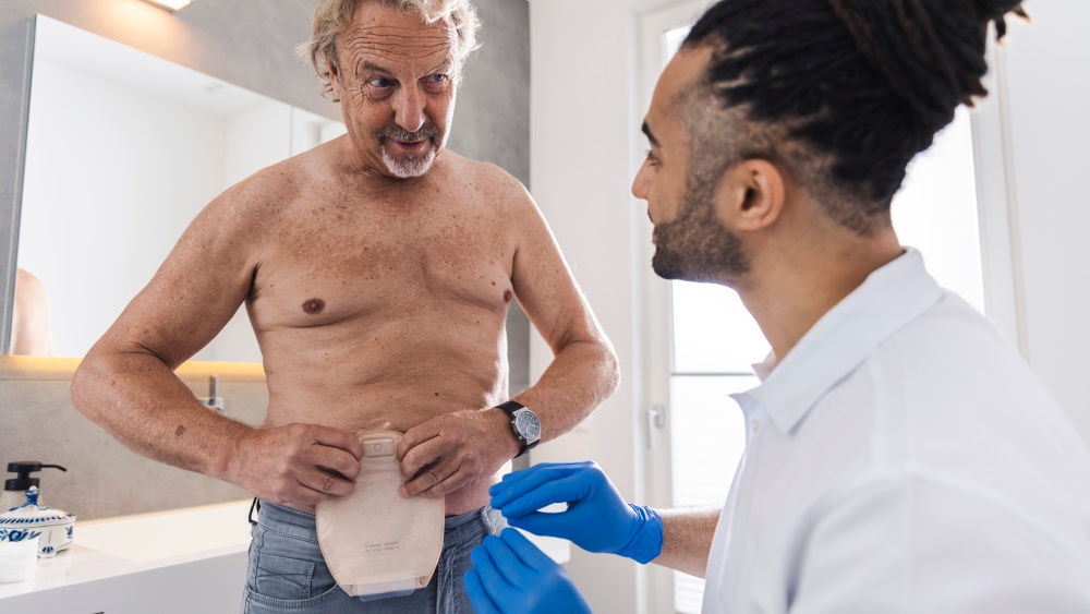 Homem com saco de ostomia na parte superior do corpo nua com enfermeiro com luvas a indicar-lhe como aplicar o saco