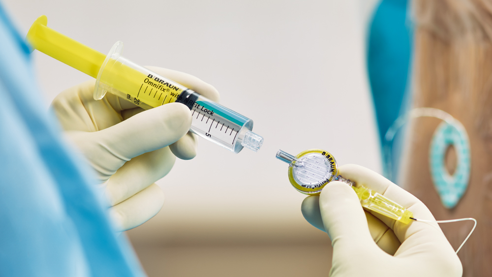 Uma seringa cheia de medicamento está ligada a um filtro que tem um conector especial para anestesia regional.