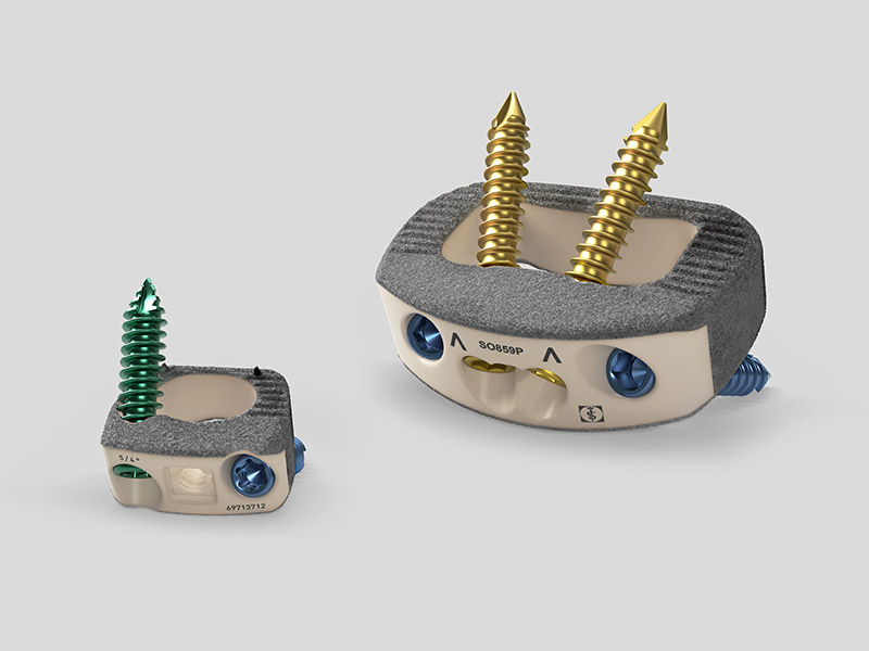 Implantes de fusão intercorporal revestidos Plasmapore XP.