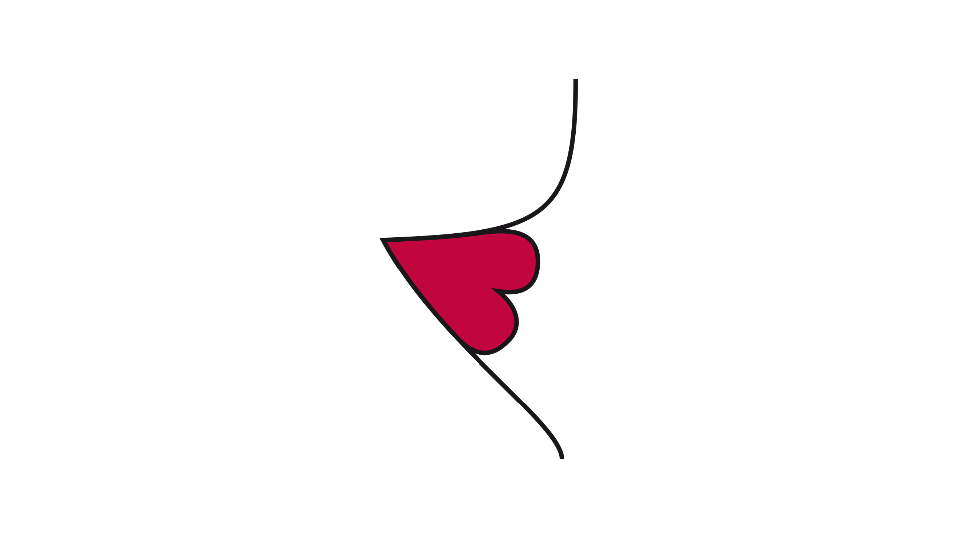 Uma ilustração de perfil de um estoma mal posicionado, onde a linha da pele abdominal forma uma ruga ou dobra acentuada e irregular, e o estoma está colocado de forma desconfortável dentro desta dobra profunda da pele.