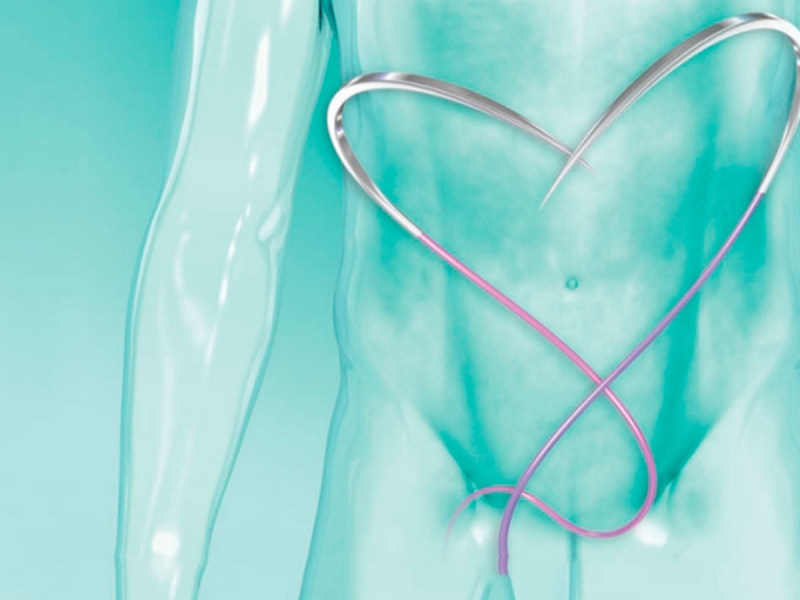 Abdominal Wall Health