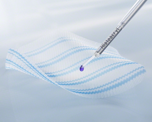 Histoacryl® LapFix Optilene® Mesh